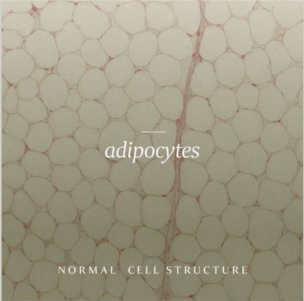 Histology of untreated subcutaneous tissue — evenly packed adipocytes with intact membranes, separated by fibrous septa