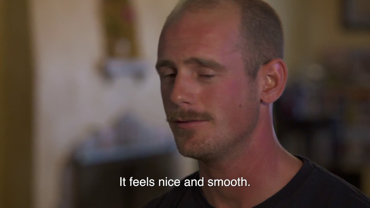 Brian — Laser Tattoo Removal at Neoderma