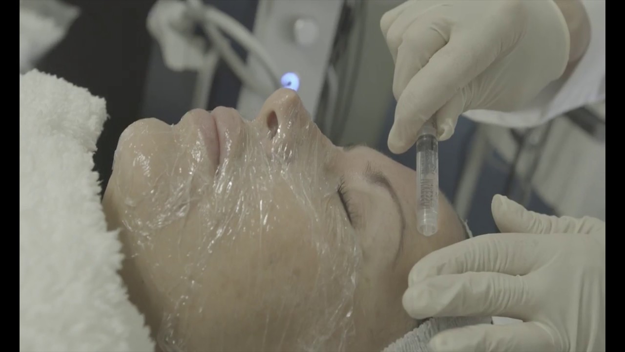 Renee's stem cell facial story at Neoderma — clearing acne scars